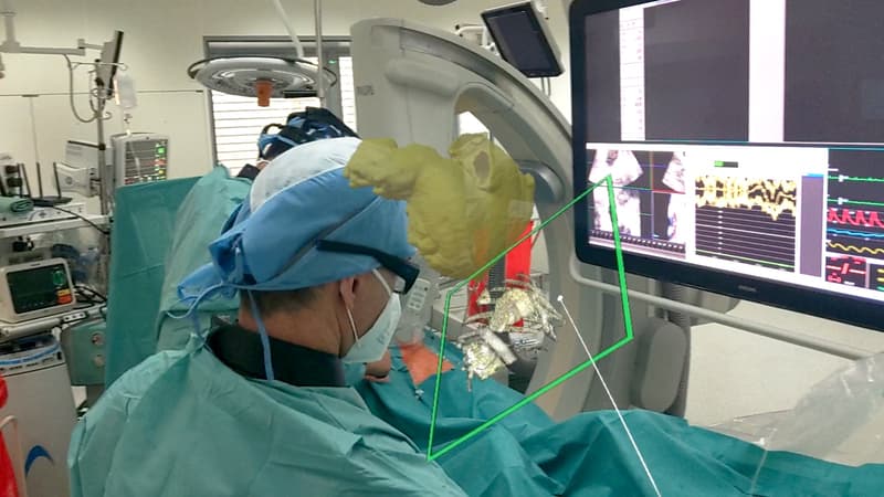 Pohled z Hololens brýlí během operace