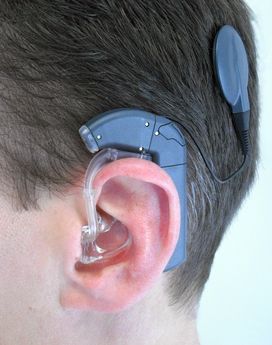 Fotografie pacienta s kochlernm implanttem (autor Zipfer)